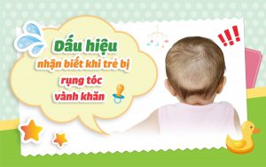 Dấu hiệu nhận biết khi trẻ bị rụng tóc vành khăn