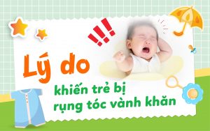 Lý do khiến trẻ bị rụng tóc vành khăn