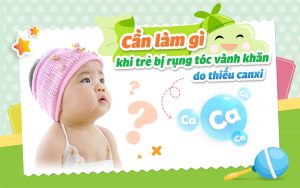 Cần làm gì khi trẻ bị rụng tóc vành khăn do thiếu canxi