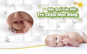 Hậu Quả Của Việc Trẻ Chậm Mọc Răng